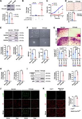 Tristetraprolin promotes survival of mammary progenitor cells by restraining TNFα levels